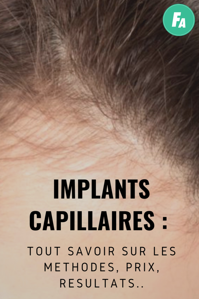 compléments capillaires Luxeol Forcapil